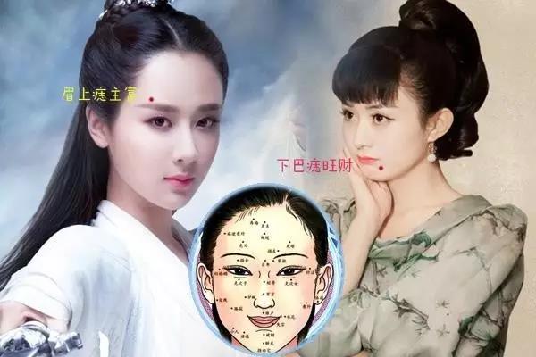 相面算命-再一次验证相书关于痣的记载(图2)